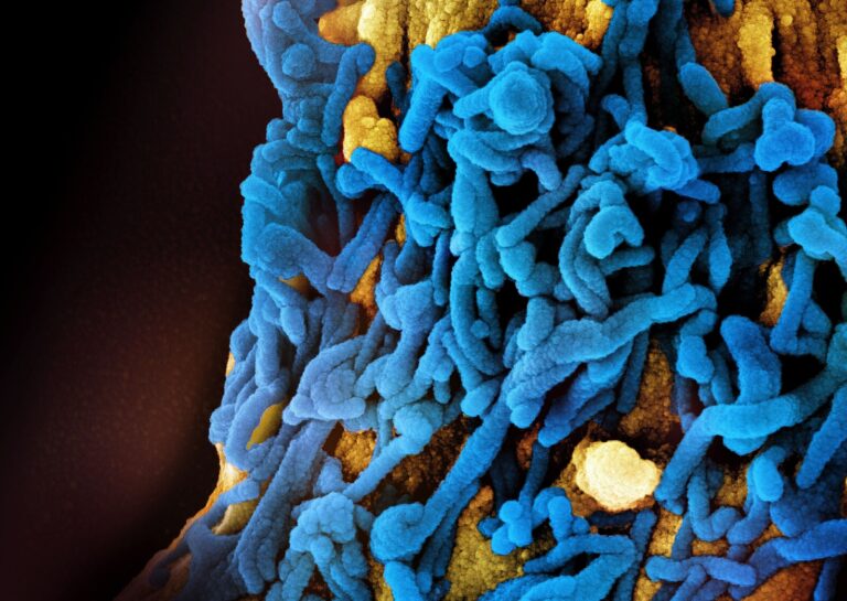 Etiópia registra surto de vírus da família do Ebola