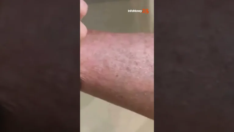 Custo da tornozeleira de Bolsonaro e multa por destruição