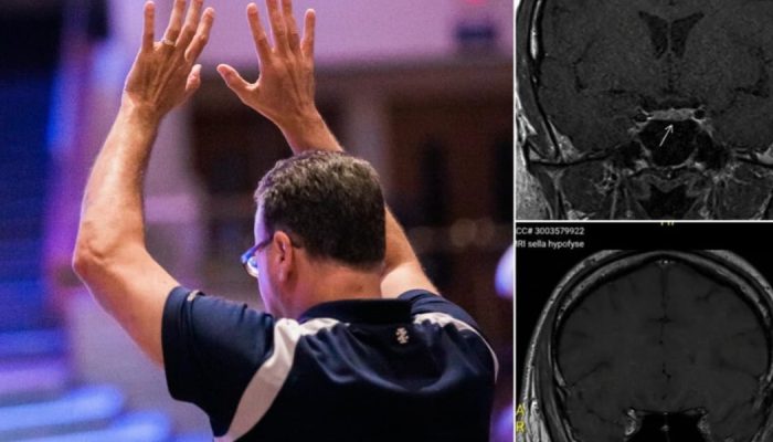 1913870494-tumor.JPG